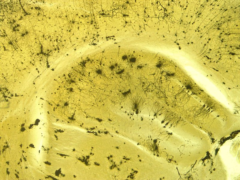 Gefärbte Nervenzellen in einem mikroskopischen Schnitt als Symbol für neurowissenschaftliche Forschung