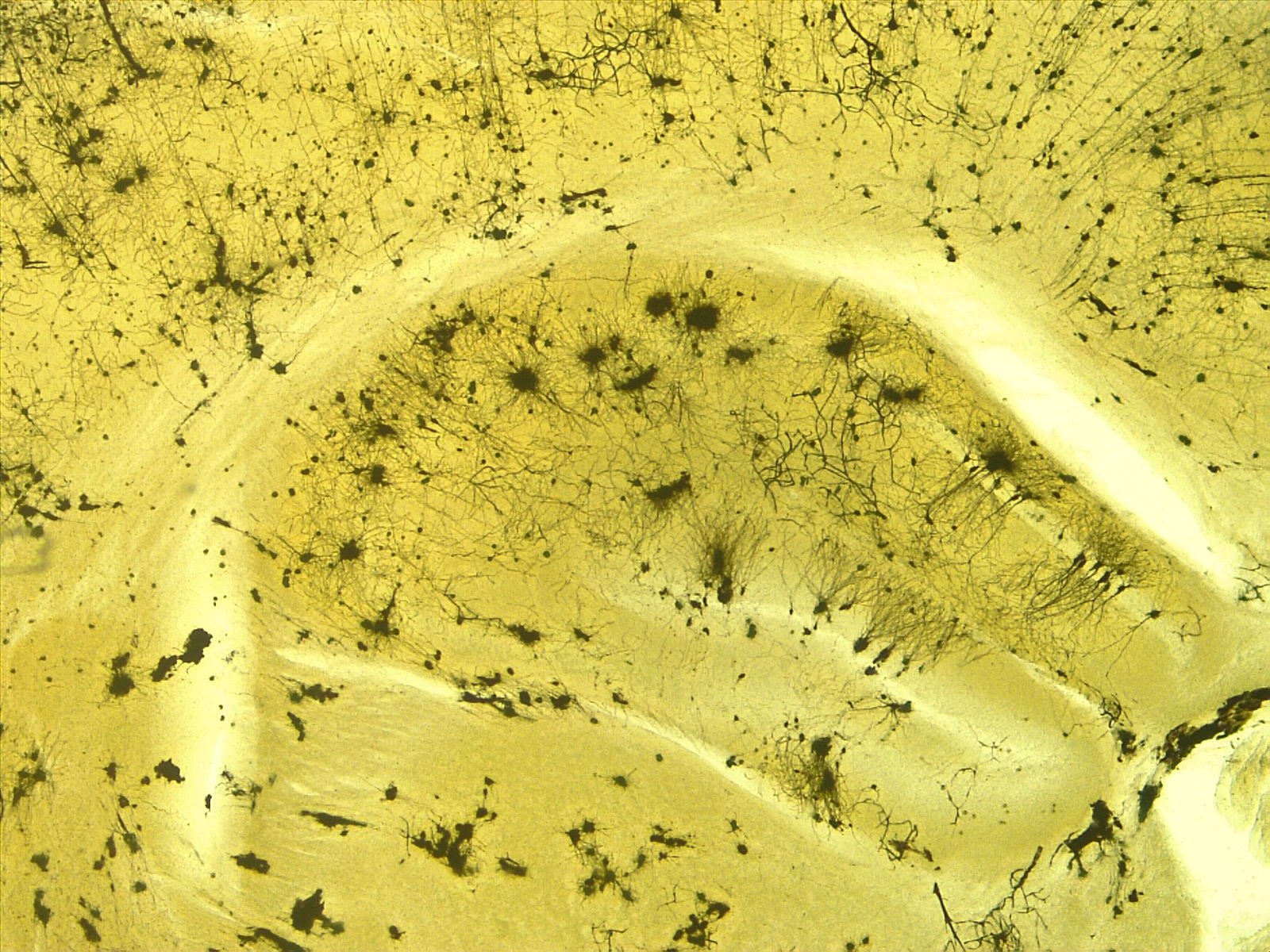 Gefärbte Nervenzellen in einem mikroskopischen Schnitt als Symbol für neurowissenschaftliche Forschung